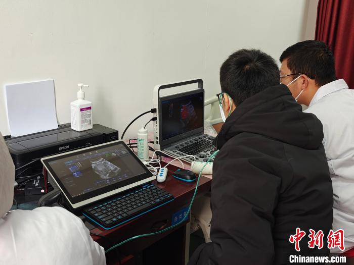 星歐注冊：AI賦能高原戰“蟲”  守護肝包蟲患者健康